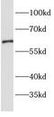 Solute carrier family 22 member 6 antibody, FNab10269, FineTest, Western Blot image 