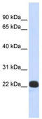 Recoverin antibody, TA334776, Origene, Western Blot image 