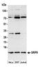 Signal Recognition Particle 9 antibody, A305-455A, Bethyl Labs, Western Blot image 