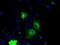 Serine/threonine-protein kinase PRKY antibody, MA5-24955, Invitrogen Antibodies, Immunocytochemistry image 