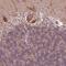 Casein Kinase 1 Gamma 2 antibody, HPA056572, Atlas Antibodies, Immunohistochemistry paraffin image 