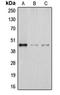 DHYS antibody, orb213847, Biorbyt, Western Blot image 