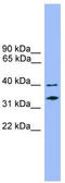 Nedd4 Family Interacting Protein 2 antibody, TA331085, Origene, Western Blot image 
