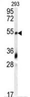 Growth Differentiation Factor 10 antibody, AP11937PU-N, Origene, Western Blot image 