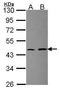 Ribosomal Protein L3 antibody, GTX114725, GeneTex, Western Blot image 
