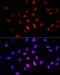 COMM domain-containing protein 1 antibody, 22-741, ProSci, Immunofluorescence image 