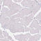 CCCTC-Binding Factor Like antibody, HPA001472, Atlas Antibodies, Immunohistochemistry paraffin image 