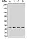 Eukaryotic translation initiation factor 3 subunit M antibody, LS-C668380, Lifespan Biosciences, Western Blot image 