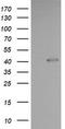 Parvin Alpha antibody, TA506003BM, Origene, Western Blot image 