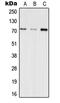 Inositol Polyphosphate-5-Phosphatase E antibody, GTX56011, GeneTex, Western Blot image 