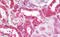 Protein Disulfide Isomerase Family A Member 3 antibody, MBS247985, MyBioSource, Immunohistochemistry paraffin image 