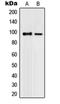 Promyelocytic leukemia protein antibody, orb214410, Biorbyt, Western Blot image 
