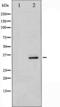 Cyclin Dependent Kinase 5 antibody, TA325347, Origene, Western Blot image 