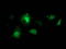BCAR1 Scaffold Protein, Cas Family Member antibody, LS-C172748, Lifespan Biosciences, Immunofluorescence image 