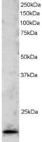 TATA box-binding protein-like protein 1 antibody, EB05614, Everest Biotech, Western Blot image 