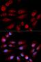 Tumor Protein P53 Binding Protein 1 antibody, LS-C334269, Lifespan Biosciences, Immunofluorescence image 