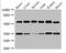 Glucosylceramidase Beta antibody, orb47367, Biorbyt, Western Blot image 