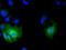 Sterol O-Acyltransferase 2 antibody, LS-C115250, Lifespan Biosciences, Immunofluorescence image 