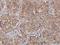 Protoporphyrinogen Oxidase antibody, H00005498-M01, Novus Biologicals, Immunohistochemistry frozen image 