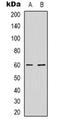 Nuclear RNA Export Factor 3 antibody, orb319025, Biorbyt, Western Blot image 