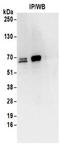 DnaJ Heat Shock Protein Family (Hsp40) Member C1 antibody, NBP2-32128, Novus Biologicals, Immunoprecipitation image 