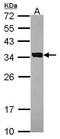 DHEA-ST antibody, PA5-30186, Invitrogen Antibodies, Western Blot image 