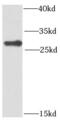 Phosphomannomutase 2 antibody, FNab06574, FineTest, Western Blot image 