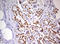 DEAD-Box Helicase 56 antibody, LS-C336691, Lifespan Biosciences, Immunohistochemistry paraffin image 