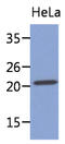 Myosin Light Chain 4 antibody, AM50061PU-N, Origene, Western Blot image 