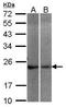 Neuronal Calcium Sensor 1 antibody, TA309002, Origene, Western Blot image 
