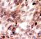Gelsolin antibody, PA2109, Boster Biological Technology, Immunocytochemistry image 