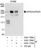 Eukaryotic translation initiation factor 4 gamma 3 antibody, A301-770A, Bethyl Labs, Immunoprecipitation image 