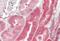Von Hippel-Lindau Tumor Suppressor antibody, GTX89268, GeneTex, Immunohistochemistry paraffin image 