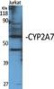 Cytochrome P450 Family 2 Subfamily A Member 7 antibody, A10507, Boster Biological Technology, Western Blot image 