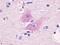 Endothelin B receptor-like protein 2 antibody, LS-A405, Lifespan Biosciences, Immunohistochemistry paraffin image 