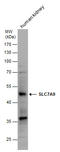 Solute Carrier Family 7 Member 9 antibody, GTX130516, GeneTex, Western Blot image 