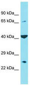 Chromosome 6 Open Reading Frame 120 antibody, TA334880, Origene, Western Blot image 
