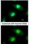 Casein kinase II subunit beta antibody, PA5-27416, Invitrogen Antibodies, Immunofluorescence image 
