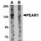 Platelet Endothelial Aggregation Receptor 1 antibody, MBS151371, MyBioSource, Western Blot image 