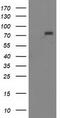 Myotubularin-related protein 2 antibody, LS-C172524, Lifespan Biosciences, Western Blot image 