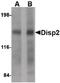 Dispatched RND Transporter Family Member 2 antibody, PA5-20631, Invitrogen Antibodies, Western Blot image 