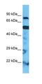 Carnitine O-palmitoyltransferase 2, mitochondrial antibody, orb331433, Biorbyt, Western Blot image 