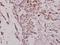 Mitogen-Activated Protein Kinase 8 antibody, A02608T178, Boster Biological Technology, Immunohistochemistry paraffin image 
