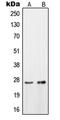 OTU Deubiquitinase, Ubiquitin Aldehyde Binding 2 antibody, GTX56189, GeneTex, Western Blot image 