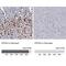 Hka antibody, NBP1-88889, Novus Biologicals, Immunohistochemistry paraffin image 