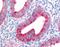 Seprase antibody, AHP1322, Bio-Rad (formerly AbD Serotec) , Immunohistochemistry paraffin image 