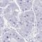 Spermatogenesis Associated Serine Rich 2 Like antibody, HPA055427, Atlas Antibodies, Immunohistochemistry paraffin image 