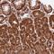 Breast Carcinoma Amplified Sequence 4 antibody, HPA038812, Atlas Antibodies, Immunohistochemistry frozen image 