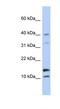 WAP Four-Disulfide Core Domain 5 antibody, NBP1-57932, Novus Biologicals, Western Blot image 
