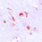 Apolipoprotein L2 antibody, LS-C353364, Lifespan Biosciences, Immunohistochemistry paraffin image 